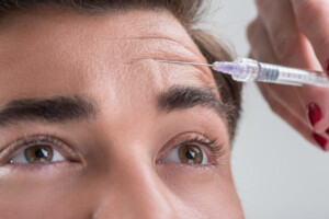 Botox Behandlung zur Faltenreduktion im Gesicht